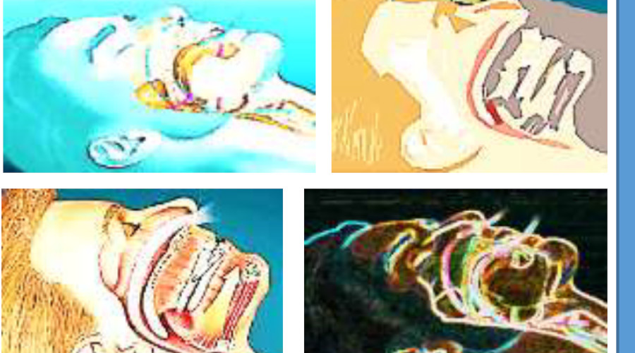 Clicca per accedere all'articolo 12 Novembre 2022 - L’odontoiatria nella diagnosi e nella terapia delle O.S.A.S